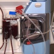 Un appareil d'hémodialyse.