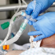 Des mains protégées par des gants bleus médicaux ajustent un tube qui permet à un patient de recevoir de l'oxygène.