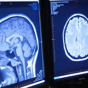 Une image d'un cerveau sur un écran.