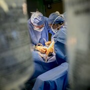 La chirurgie peut prendre jusqu'à deux heures.  