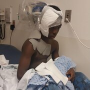 Un enfant porte des pansements sur des br&ucirc;lures.