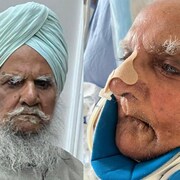 Joginder Singh Kaler, avec et sans barbe à l'hôpital.