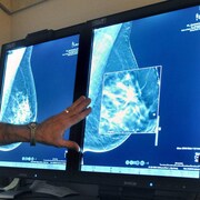 Une main d’homme (probablement d’un travailleur de la santé) est posée sur un double écran où on voit des images d’une mammographie.