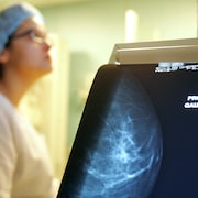 A technician before a screen and mammogram. 