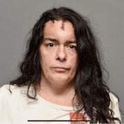 La femme aux longs cheveux noirs portes des blessures visibles sur le front et la tête.