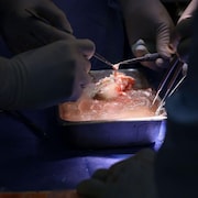 Le rein de porc, quelques instants avant la transplantation.