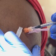 Gros plan sur une seringue injectant une dose de vaccin dans le bras de quelqu'un. 