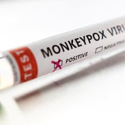Une éprouvette de laboratoire affichant un résultat positif à un test de la variole du singe.