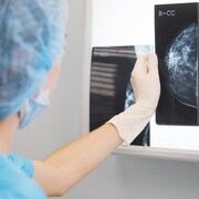 Une médecin tient une mammographie devant un écran lumineux.