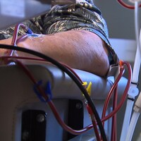 Un patient subit une dialyse.
