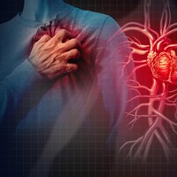 Illustration d'un homme victime d'une crise cardiaque.