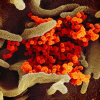 Le virus SRAS-CoV-2 apparaît en orange alors qu'il colonise la surface de cellules (en vert).