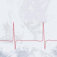 Image d'un électrocardiogramme