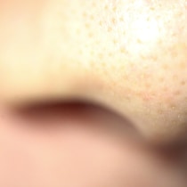 On voit en gros plan le nez d'un homme.