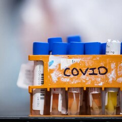 Des écouvillons dans un laboratoire de Surrey, en Colombie-Britannique, le 26 mars 2020.