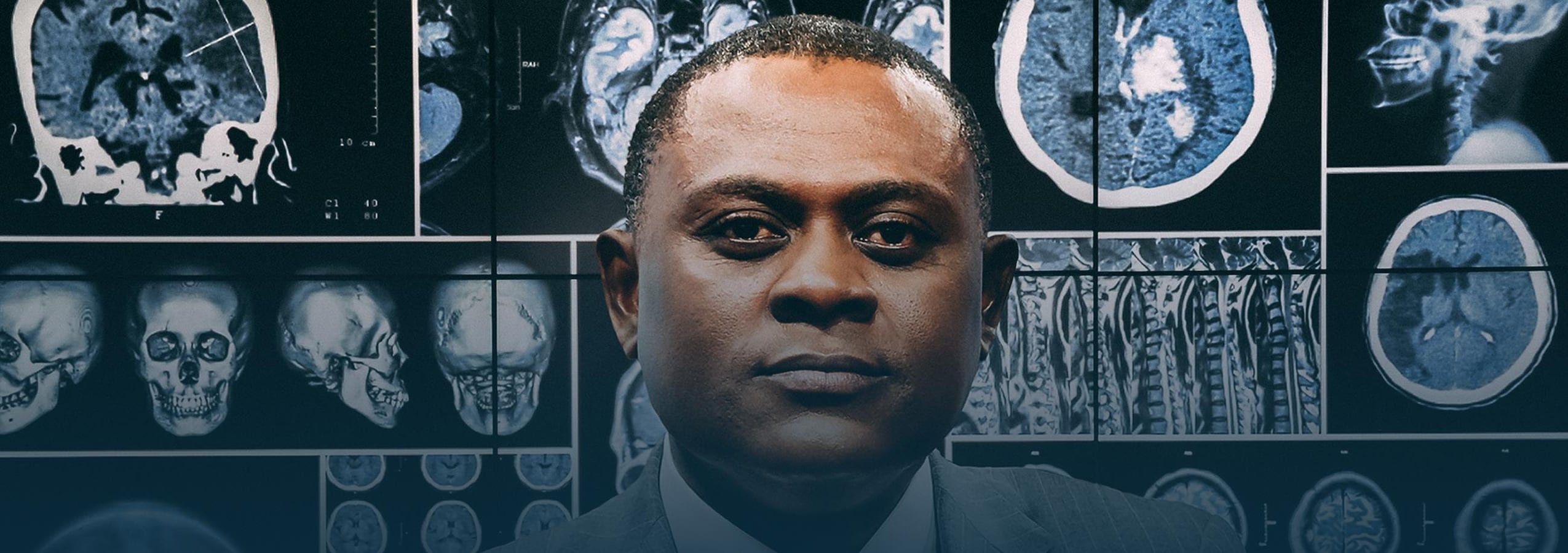 Tout ce que je cherchais, c’est la vérité - Dr Bennet Omalu Le Dr Bennet Omalu se tient devant des planches de scans de cerveaux humains.