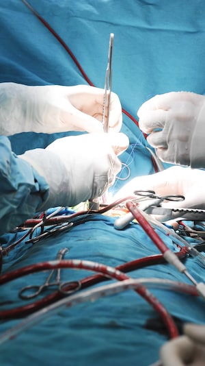 Une chirurgie dans un bloc opératoire.