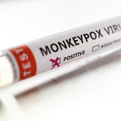 Une éprouvette de laboratoire affichant un résultat positif à un test de variole simienne.