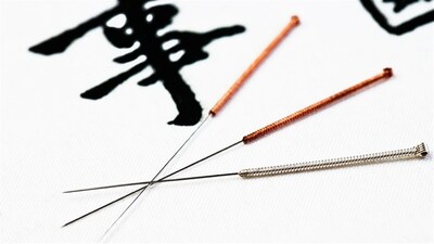 L'acupuncture est pratiquée depuis des millénaires.