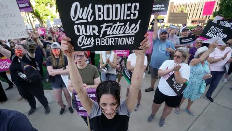 Abortion-rights protesters in Lansing, Mich., cheer at a rally June 24 following the U.S. Supreme Court's decision to overturn Roe v. Wade. Advocates in the state say they'd like to see Canadian politicians put actions behind their words of support for women seeking abortions. (Paul Sancya/The Associated Press)