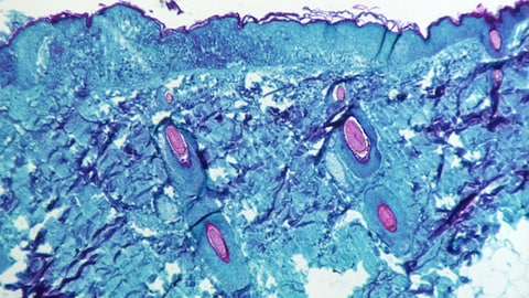 Una imagen tomada por microscopio.
