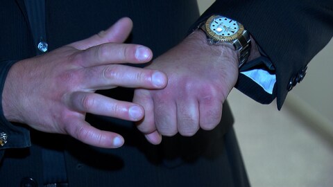 Les mains de David Lemieux Les mains de David Lemieux