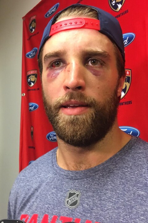 Aaron Ekblad Aaron Ekblad