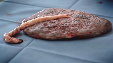 Un placenta.