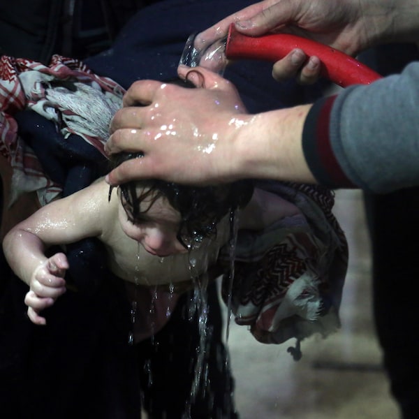 Un enfant est traité dans un hôpital de Douma, dans l'est de la Ghouta, en Syrie, après une attaque chimique alléguée.
