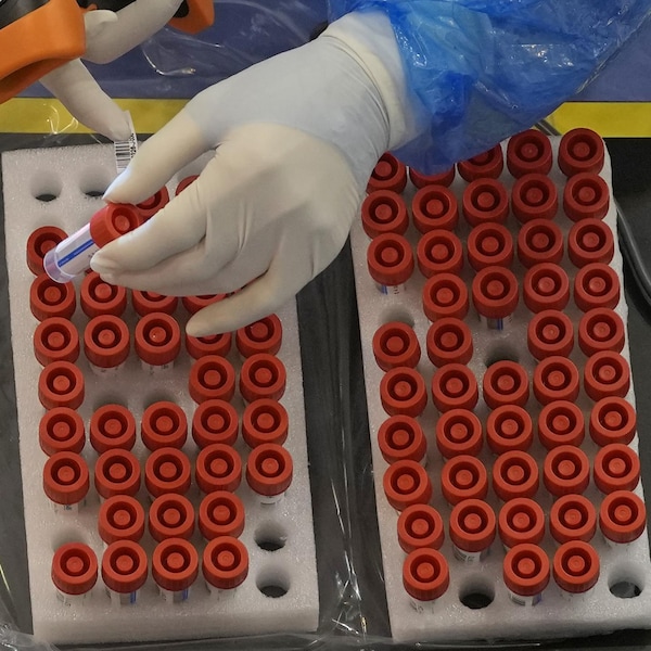 Photo prise de haut de dizaines de tubes d'échantillons avec des bouchons rouges. On voit deux mains qui manipulent une étiqueteuse pour apposer des étiquettes sur les tubes.