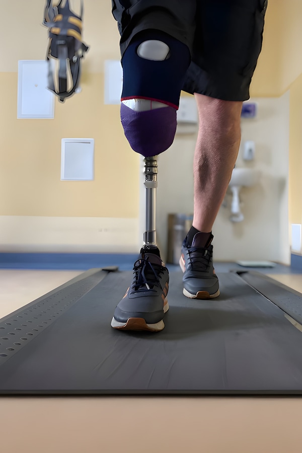 Un homme avec une prothèse en guise de jambe marche sur un tapis roulant.