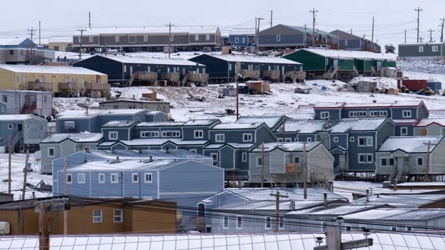 Le Nunavut déclare une épidémie de tuberculose à Pond Inlet