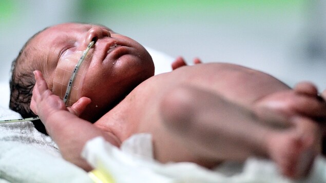 Un bébé prématuré dans un incubateur, avec un tube qui l'aide à respirer dans le nez.