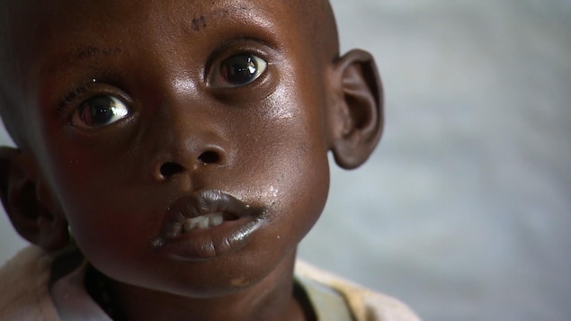 Un petit garçon à l'hôpital d'Al-Sabah de Djouba, au Soudan du Sud