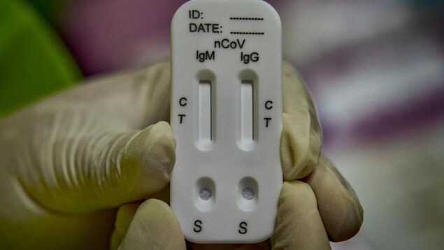Un test sérologique tenu dans les mains d'un membre du personnel soignant, avec des gants.