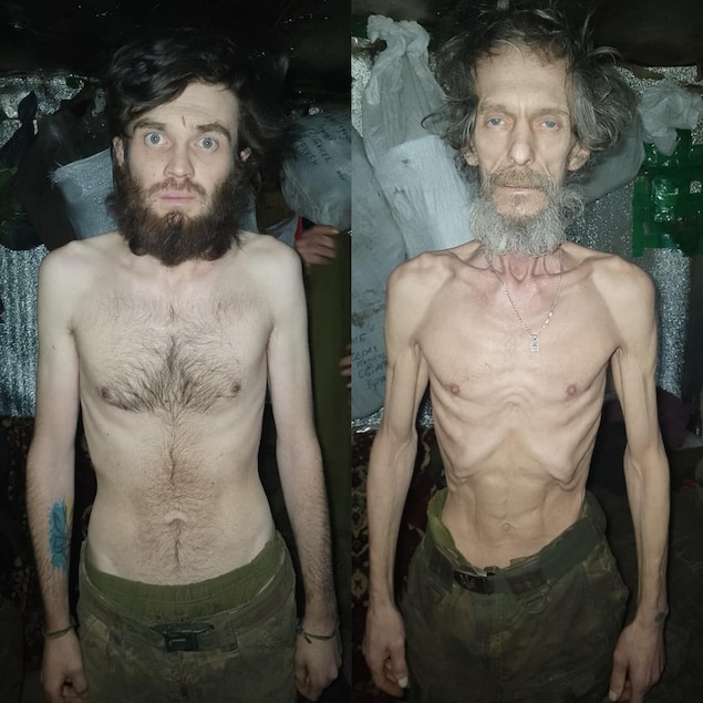 Deux hommes très maigres torse nu.