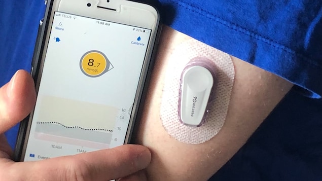 L’Alberta paie les appareils de surveillance du glucose des jeunes diabétiques
