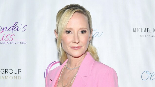 Anne Heche a succombé à des brûlures et à l’inhalation de fumée