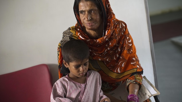 Mumtaz Bibi, défigurée par l'acide, attend avec son fils à l'hôpital de Rawalpindi. Mumtaz Bibi, défigurée par l'acide, attend avec son fils à l'hôpital de Rawalpindi.