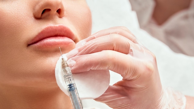 Injection de Botox dans les lèvres.