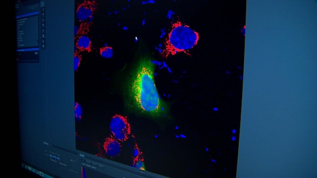 Une dizaine de protéines contenues dans une même cellules sont colorées en bleu. On y distingue facilement l'enzyme SRMS par sa couleur verte. Une dizaine de protéines contenues dans une même cellules sont colorées en bleu. On y distingue facilement l'enzyme SRMS par sa couleur verte.