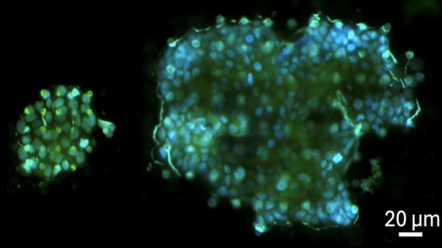 Les cellules tumorales métastatiques se déplacent dans la circulation sanguine sous forme d'amas.