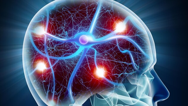 Représentation d'un neurone dans le cerveau