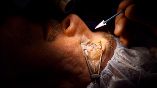 10 mois d’attente pour une chirurgie de la cataracte en Montérégie-Ouest