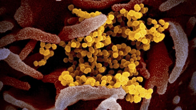 On voit en gros plan de petit virus de forme ronde, agglutinés, sur une surface ondulée.