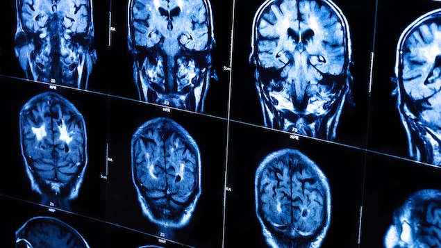 Plusieurs numérisations d’un crâne humain dans un service de radiologie.