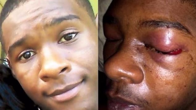 Dafonte Miller ne voit plus de son oeil gauche