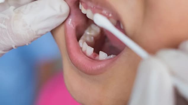 The Liberal-NDP agreement includes a plan to create a new national dental care program for low-income Canadians. (Shutterstock / chanchai plongern)