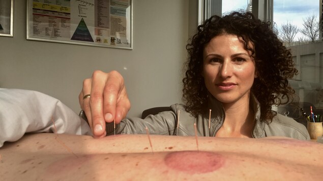 Dominique Vallée plante des aiguilles d'acupuncture dans le corps d'un patient. Dominique Vallée plante des aiguilles d'acupuncture dans le corps d'un patient.
