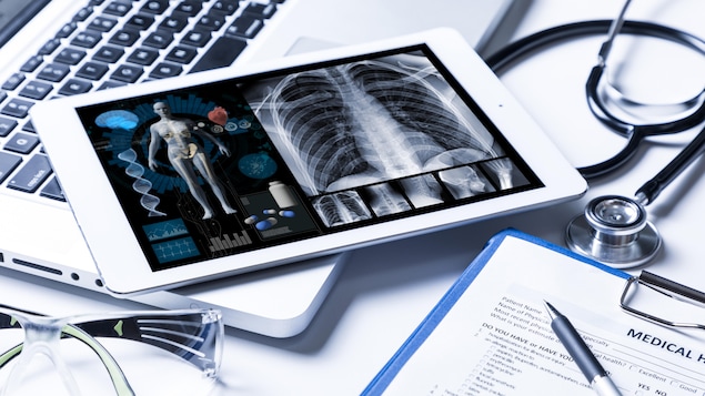 Une tablette électronique affichant une représentation du corps humain